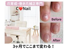 シーネイル(C Nail)