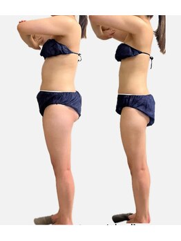 パームボーテ(Palm Beaute)/【オリジナル痩身】マイナス10kg