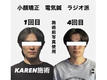 クリアランス 南青山(CLEARANCE)/施術回数4回　KAREN担当