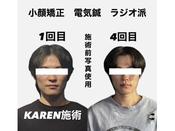 クリアランス 南青山(CLEARANCE)/施術回数4回　KAREN担当