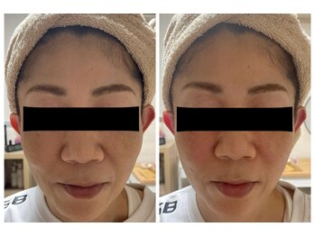 ネムズヴェリタ(nemu's Verita)の写真/小顔・たるみ・左右非対称・首肩凝り・頭痛・脳疲労・眼精疲労には本格コルギ小顔ケア