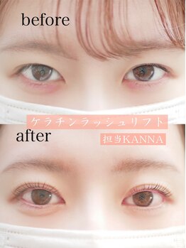 アイシェリー(eyecherie)/ケラチンラッシュリフト