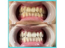 15分x3セット1回目 8トーンUP