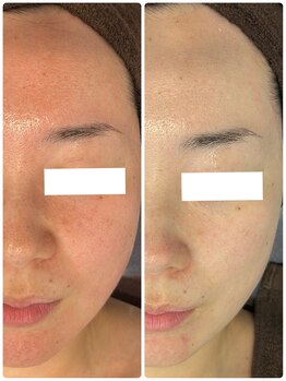 グラサヴォーグ 金沢店/エクスライジングの結果がすごい