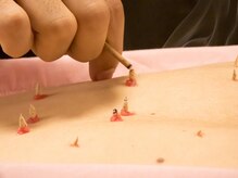 仙灸堂/お身体整えます