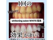 ホワイトニングサロン ホワイト(WHITE)/セルフホワイトニング/大阪/福島