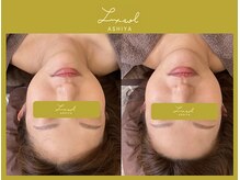 ルク ソル(Luxsol)/ヘッドスパ&リンパマッサージ