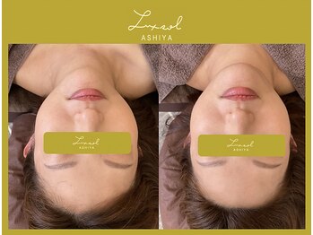 ルク ソル(Luxsol)/ヘッドスパ&リンパマッサージ