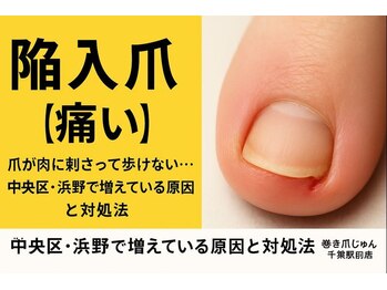 巻き爪じゅん 千葉駅前店/増えている陥入爪の原因と対処法