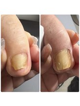 リエンダ ネイル(Leende nail)/フットケア