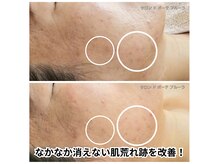 サロン ド ボーテ プルーラ(Salon de beaute PLURA)
