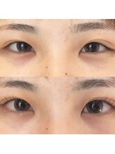 シルフ 宝塚店(Sylph)/