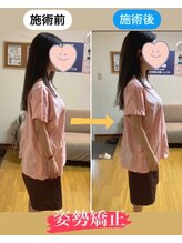 ホジュン鍼灸整体院/猫背改善