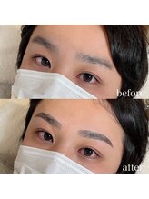 ダリ(Dali)/メンズハリウッドブロウリフト