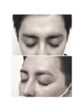 アイビー 神保町店(i.b)/眉【before⇒after】５７