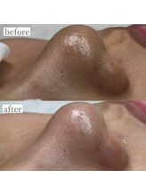 ライカブルー(RaicA BluE)/施術写真　before-after