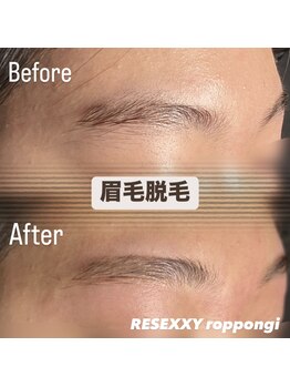 リゼクシー INTERNATIONAL麻布十番 六本木(RESEXXY)/