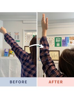 ひので整体/肩の上がりづらさお任せください
