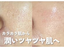 ホワイトアクア 鹿児島店(WHITE AQUA)/ララピール/鹿児島ララピール