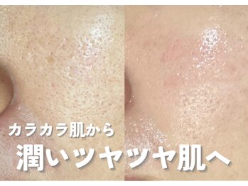 ホワイトアクア 鹿児島店(WHITE AQUA)/ララピール/鹿児島ララピール