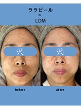 リスキン(Reskin)/《トーンアップ、リフトアップ》