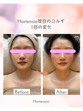 オルテンシア(Hortensia)/コルギ☆ビフォーアフター