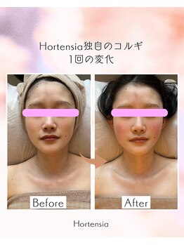 オルテンシア(Hortensia)/コルギ☆ビフォーアフター