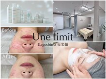 アンリミット 鹿児島天文館店(Une limit)