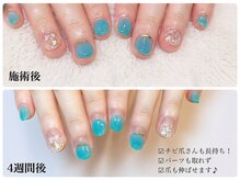 ヴィセオ(Viseo)/【チビ爪さんも取れずに長持ち】