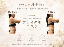エステティックサロン サロン ド ヴィーナス 新宿店/ブライダルエステ