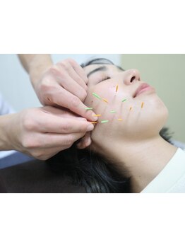 小顔になりたい