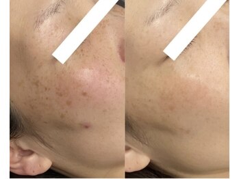 ボンズ(bonds.)/完全オーダーメイドの肌管理