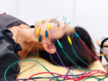 結び鍼灸院の写真/【鍼灸師による美容鍼がオススメ*】髪の毛より細い鍼を使用し人の手では届かない筋肉に直接アプローチ♪