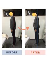 アミーゴ整体院/ビフォーアフター