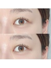 アルビス バイ エニーハウ(Arbis by anyhow)/ラッシュリフト（まつげパーマ）