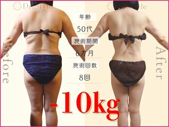 ココア整体 岐阜店(cocoa整体)/最新痩身マシン/脂肪燃焼リンパ