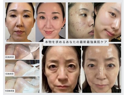 リリーガーデン(Lily Garden)の写真