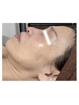 メディカルサロン かとれあ/ダクトピール