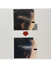 イーズ/リバイタ グランツリー武蔵小杉店/【ケース8】20代女性