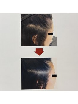 イーズ/リバイタ グランツリー武蔵小杉店/【ケース8】20代女性