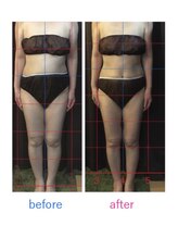 タカラ整体 四日市店/ビフォーアフター