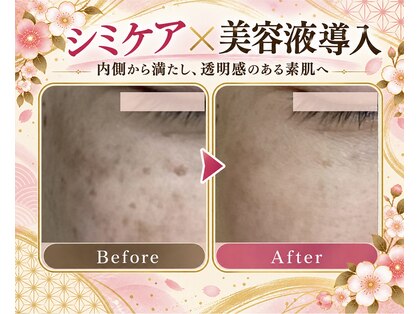カイセイドウ(KAISEIDO)の写真