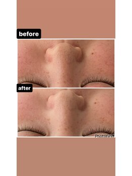 メナードフェイシャルサロン 岐阜茜部/クリーンパック