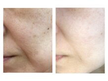 ヴィヴ コレビ(VIV COREBI)/悩み改善