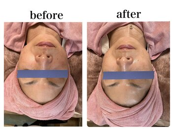 KMB 中崎町店/ワイコォーピーリング　