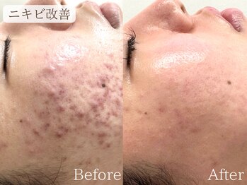 サロン ド ペオニー 川内店(salon de peony)