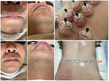 シャイニースキン(Shiny skin)の写真