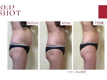 イージー(EASY)/RED SHOT 10ml