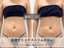 フルーブラン(Frubran)/本気の全身スリムケア