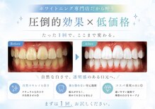 LBSホワイトニング 上野店